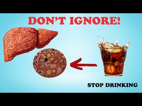 Beware of These Foods: Hidden Dangers to Your Liver | Healthy Care